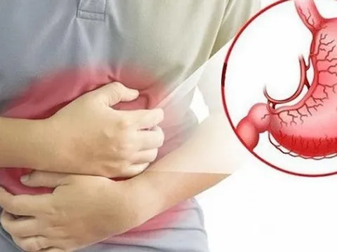 15 tuổi thủng dạ dày: Bác sĩ điểm danh 'thủ phạm', chỉ cách phòng ngừa