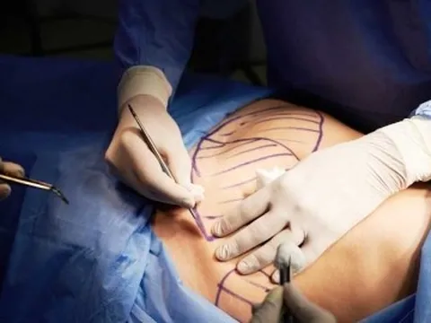 Người phụ nữ mất 6 lít máu sau hút mỡ tại Bệnh viện chuyên khoa Thẩm mỹ Đông Á