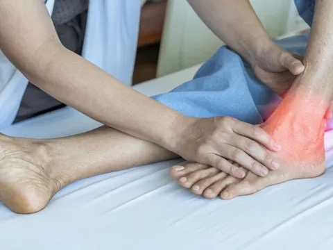 Phát hiện điều "chết người" chưa từng biết theo sau bệnh gout, viêm ruột