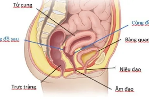 Cô gái chảy máu ổ bụng, tính mạng nguy kịch sau quan hệ tình dục