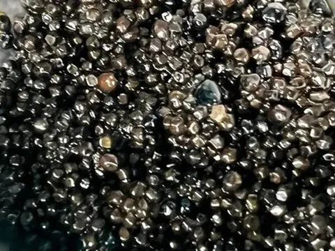 Đau bụng đi khám, người phụ nữ có hàng nghìn viên sỏi mật: Dấu hiệu cảnh báo là gì?