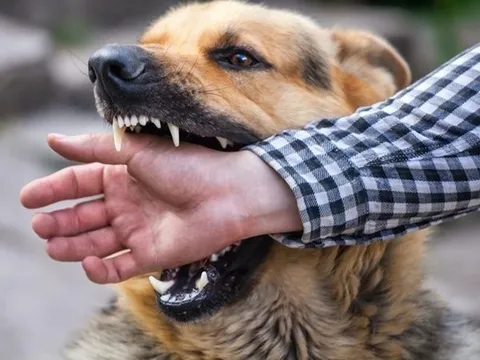 Tiêu hủy con chó mắc bệnh dại cắn 6 người ở Hà Nội