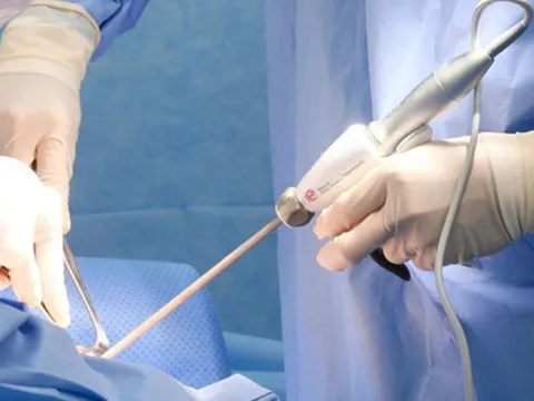 Người bệnh tử vong sau khi nâng ngực tại khách sạn: Sở Y tế TP. Hồ Chí Minh lên tiếng