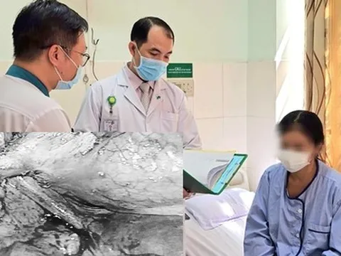 Nữ bệnh nhân mắc chứng bệnh hiếm gặp, đi tiểu ra những sợi tóc