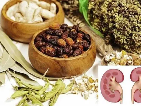 Suýt mất quả thận vì tự ý điều trị sỏi thận bằng thuốc đông y