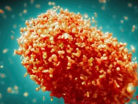 Thái Lan ghi nhận số ca mắc đậu mùa khỉ tăng vọt trong tháng 6