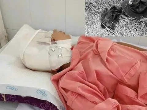 Gia cảnh đáng thương của bé gái bị cuốn vào máy cắt đứt lìa phần da đầu