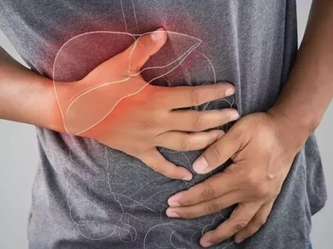 8 dấu hiệu cho thấy độc tố tích tụ quá nhiều trong gan