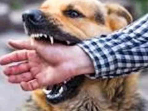 Đồng Nai: Người đàn ông tử vong do bị chó nhà mắc bệnh dại cắn