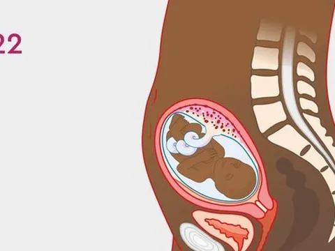 Nhập viện cấp cứu sau khi phá thai 22 tuần ở phòng khám tư