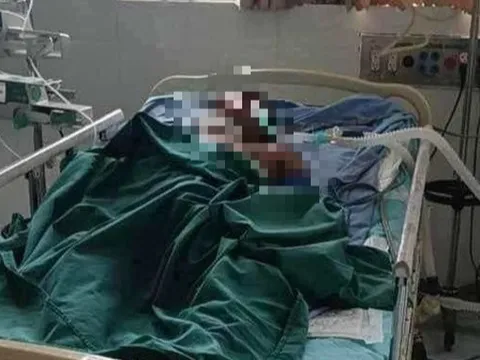 Người đàn ông 31 tuổi bị ong đốt tử vong