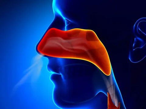 Mũi cũng có thể bị ung thư: Hãy cảnh giác với 5 dấu hiệu này