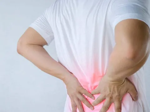 Người đàn ông suýt phải cắt bỏ thận sau vài ngày đau thắt lưng