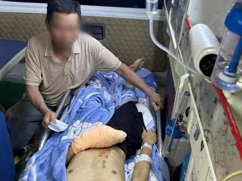 Sau tiếng nổ lớn, nam sinh lớp 12 bị dập nát bàn tay