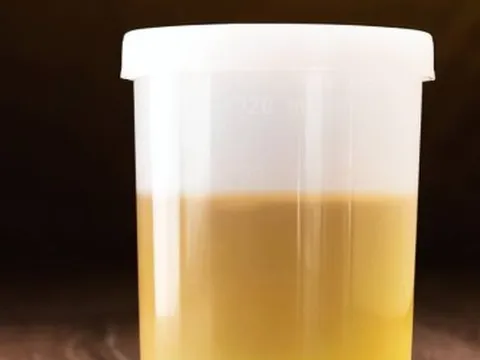 '3 vàng' trên cơ thể báo hiệu sức khoẻ bạn gặp vấn đề, cần gặp bác sĩ ngay