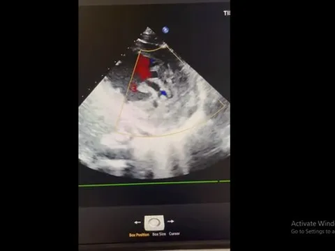 Bệnh viện Thủ Đức phát hiện ca bệnh hiếm gặp