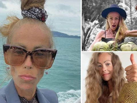 Những bức ảnh đáng sợ của nữ blogger tử vong sau khi ăn kiêng khắc nghiệt