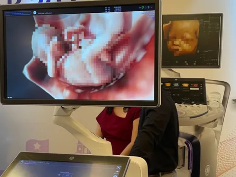 Thuốc phá thai bán thoải mái, chuyên gia đề xuất quản lý