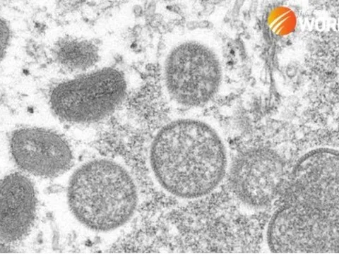 Thái Lan ghi nhận ca tử vong đầu tiên do đậu mùa khỉ