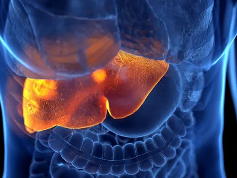 10 nguyên nhân không ngờ gây suy gan cấp: Số 3 nhiều người dễ mắc