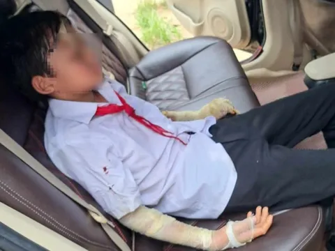 Nổ bóng bay, 7 học sinh nhập viện