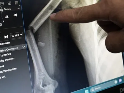 Người phụ nữ nhảy xuống từ tầng 9 chung cư mini trải qua 2 lần phẫu thuật