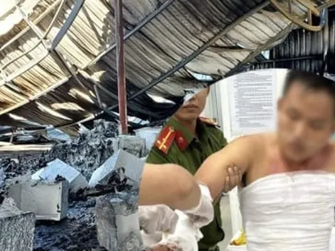 Chiến sỹ PCCC bị bỏng nặng khi chữa cháy ở Ninh Thuận