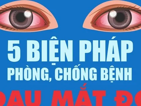 Infographic: 5 biện pháp phòng, chống bệnh đau mắt đỏ