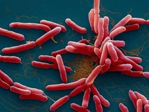 Cô gái 15 tuổi tử vong vì căn bệnh hiếm người mắc phải