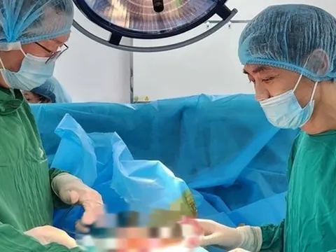 Khi nào cần nâng cấp "cậu nhỏ"?