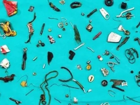 Bác sỹ sốc khi phát hiện cả 'nhà kho' gồm 60 món đồ trong bụng bệnh nhân