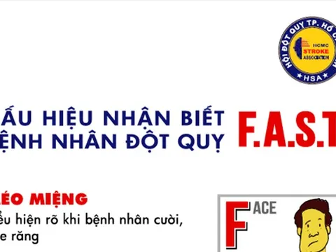 Khi nào và ai nên tầm soát đột quỵ?