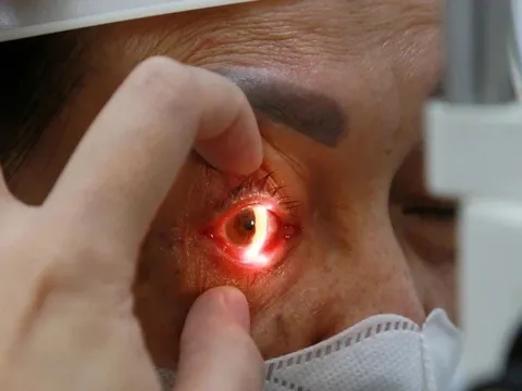 6 "không" trong thời điểm dịch đau mắt đỏ đang diễn biến phức tạp