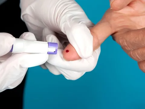 Xét nghiệm nửa giọt máu, phát hiện tất cả các loại ung thư?