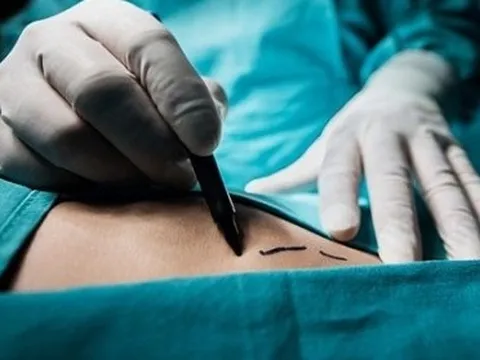 Bộ Y tế chỉ đạo khẩn sau thông tin phản ánh đường dây mua bán thận