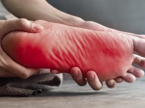 Cảm giác kiến bò ở lòng chân có thể cảnh báo bệnh lý mãn tính nguy hiểm