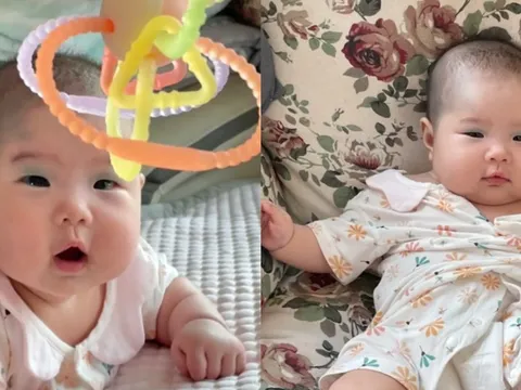 Em bé chào đời với vết bớt độc nhất vô nhị trên mặt, cư dân mạng đùa rằng: "Bé trang điểm để gặp mẹ"