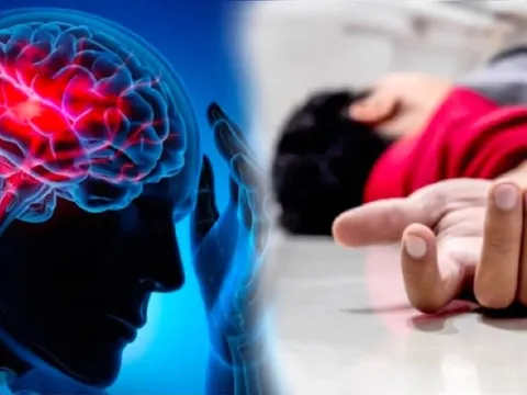 Thanh niên 20 tuổi mắc nhồi máu não, bác sĩ sửng sốt vì ‘mạch máu như người 50 tuổi’: Nguyên nhân do đâu?