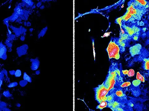 Phát hiện cơ quan xúc giác hoàn toàn mới ở người