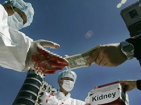 Bóc trần thủ đoạn của đường dây mua bán nội tạng người quy mô toàn quốc: 1 quả thận giá 1,45 tỷ