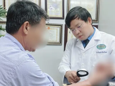 Hối hận vì đắp nhựa cây xương rồng như "thần dược" chữa viêm da cơ địa