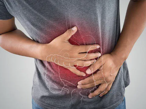 Một vị trí đau tại bụng cảnh báo ung thư đại trực tràng: Nếu có cần đi khám ngay