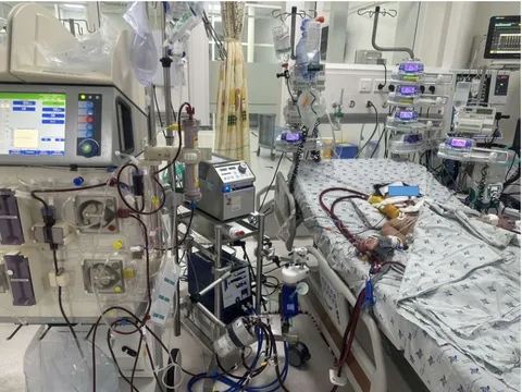 Cứu 2 anh em bị ong vò vẽ đốt hàng chục vết nguy kịch