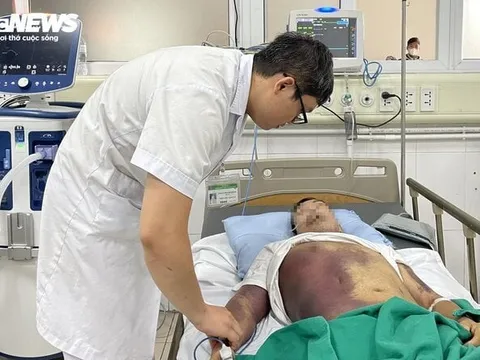 Tím đen toàn thân, gia đình phải xin đưa về sau 2 tuần điều trị sốt xuất huyết