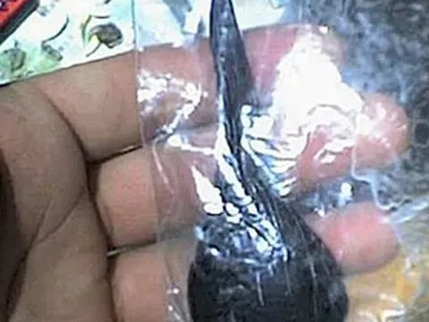 Hai người ngộ độc nặng sau khi ăn mật cá trắm để bồi bổ