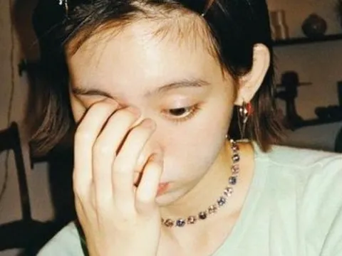 Thấy gân xanh nổi rõ ở 4 nơi này trên cơ thể tốt nhất là mau đi khám