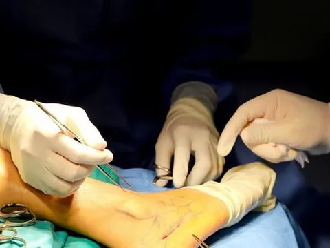 Người phụ nữ gãy xương khắp cơ thể vì căn bệnh cực hiếm gặp