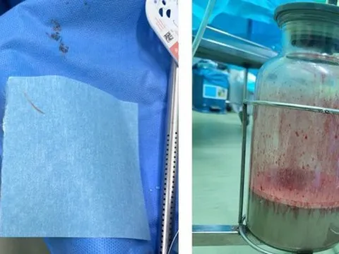 Thói quen vừa ăn, vừa nói khiến bệnh nhân suýt chết