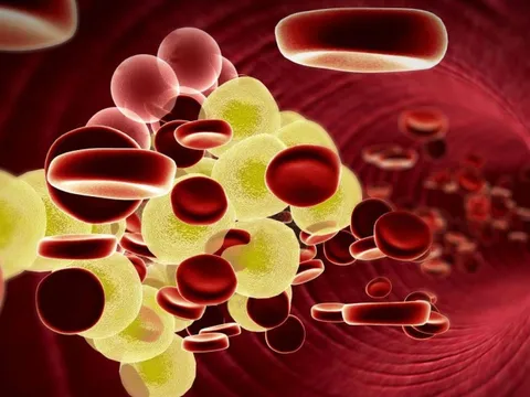 Người gầy vẫn mỡ máu cao: Bác sĩ chỉ ra 4 ‘thủ phạm’, trong đó 3 điều cuối có thể thay đổi được