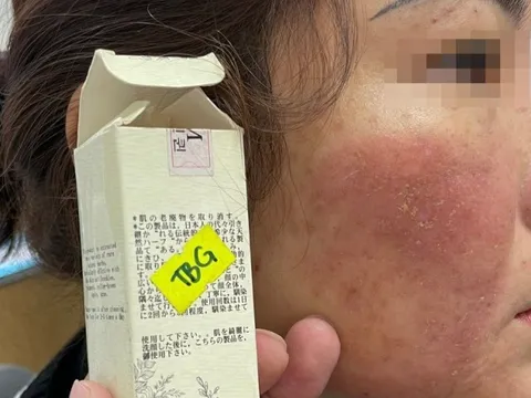 Làm đẹp cấp tốc đón Tết, nhiều ca biến chứng vì tin “bác sĩ tự phong”